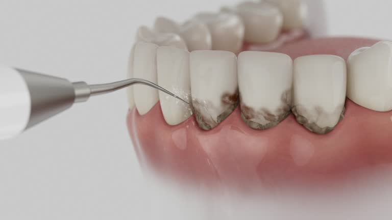 Trusted Dental Implants service in Princeton, NC - Dentist Open Now